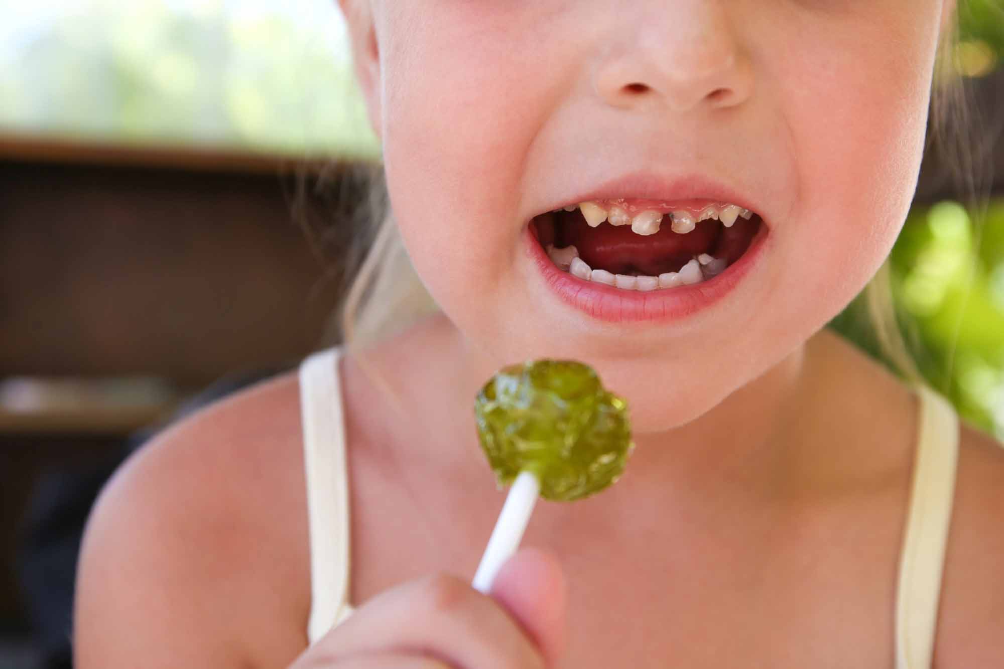 Child eating candy, ruining his teeth - Smart Pediatric Dentistry, Utah