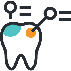 dental fillings - Smart Pediatric Dentistry, Utah